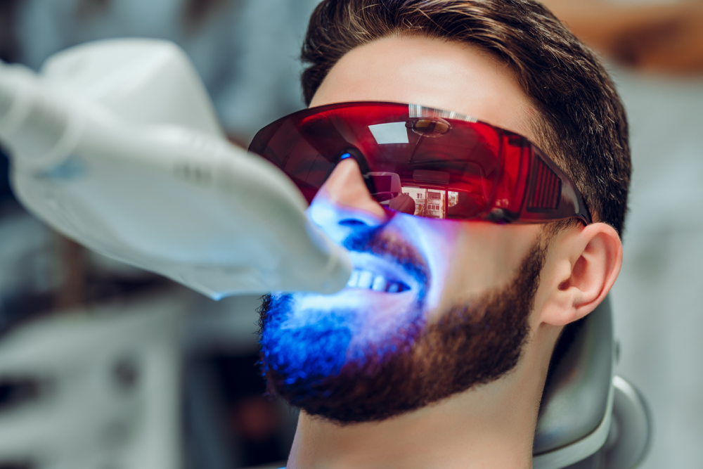 Professional Teeth Whitening 101 - All You Need to Know